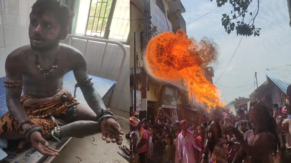 हादसा: हरदोई में गणेश महोत्सव के दौरान शिव तांडव नृत्य करते समय कलाकार आग की चपेट में आकर झुलसा